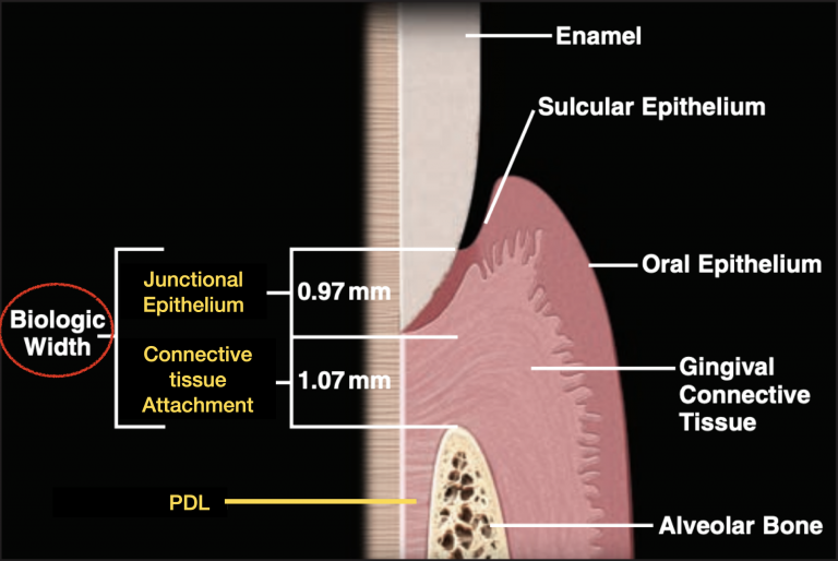 <strong>What is biologic width?</strong>