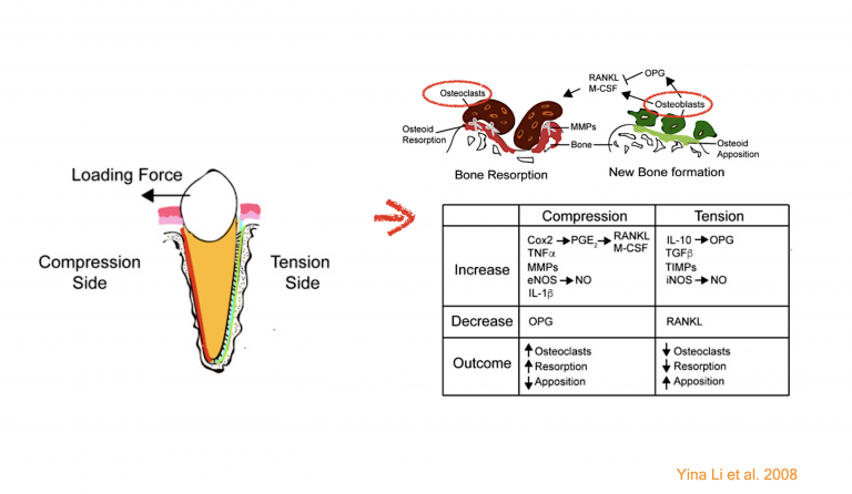 3 top periodontal complications ที่พบบ่อยในระหว่างการจัดฟัน
